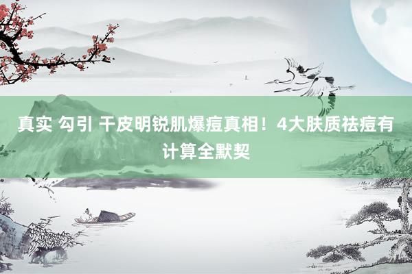 真实 勾引 干皮明锐肌爆痘真相！4大肤质祛痘有计算全默契